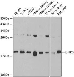 Anti-SNX3 antibody used in Western Blot (WB). GTX32888