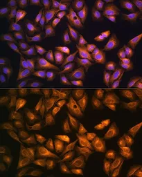 Anti-SOAT1 antibody used in Immunocytochemistry/ Immunofluorescence (ICC/IF). GTX32890
