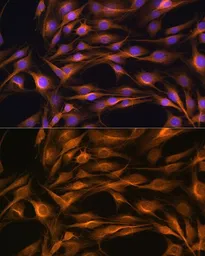 Anti-SOAT1 antibody used in Immunocytochemistry/ Immunofluorescence (ICC/IF). GTX32890