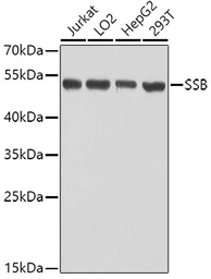 Anti-SSB antibody used in Western Blot (WB). GTX32896