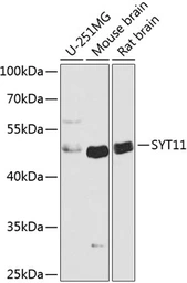 Anti-SYT11 antibody used in Western Blot (WB). GTX32905