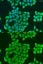 Anti-SYT11 antibody used in Immunocytochemistry/ Immunofluorescence (ICC/IF). GTX32905