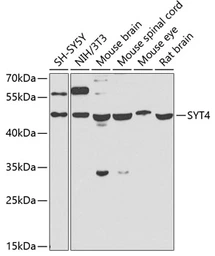 Anti-SYT4 antibody used in Western Blot (WB). GTX32906