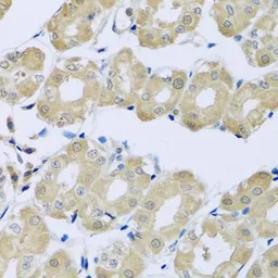 Anti-SYT4 antibody used in IHC (Paraffin sections) (IHC-P). GTX32906