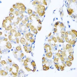 Anti-TARC antibody used in IHC (Paraffin sections) (IHC-P). GTX32911