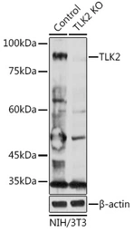 Anti-TLK2 antibody used in Western Blot (WB). GTX32923