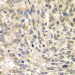 Anti-TLK2 antibody used in IHC (Paraffin sections) (IHC-P). GTX32923