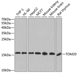 Anti-TOMM20 antibody used in Western Blot (WB). GTX32928