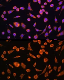 Anti-TOMM20 antibody used in Immunocytochemistry/ Immunofluorescence (ICC/IF). GTX32928