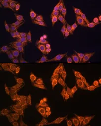 Anti-TOMM20 antibody used in Immunocytochemistry/ Immunofluorescence (ICC/IF). GTX32928