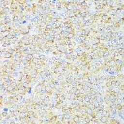 Anti-TOMM20 antibody used in IHC (Paraffin sections) (IHC-P). GTX32928