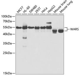 Anti-Tryptophanyl tRNA synthetase antibody used in Western Blot (WB). GTX32939