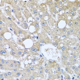 Anti-TUBGCP3 antibody used in IHC (Paraffin sections) (IHC-P). GTX32942