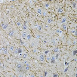 Anti-VGAT antibody used in IHC (Paraffin sections) (IHC-P). GTX32964