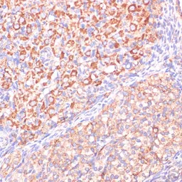 Anti-Von Hippel Lindau antibody used in IHC (Paraffin sections) (IHC-P). GTX32968