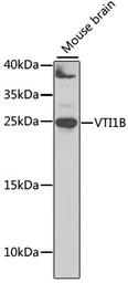 Anti-VTI1B antibody used in Western Blot (WB). GTX32969