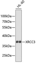 Anti-XRCC3 antibody used in Western Blot (WB). GTX32975