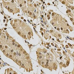 Anti-XRCC3 antibody used in IHC (Paraffin sections) (IHC-P). GTX32975