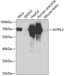 Anti-ALPPL2 antibody used in Western Blot (WB). GTX33005