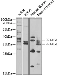 Anti-AMPK gamma 1 antibody used in Western Blot (WB). GTX33006