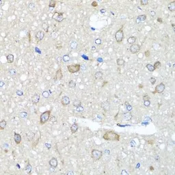 Anti-AMPK gamma 1 antibody used in IHC (Paraffin sections) (IHC-P). GTX33006
