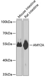 Anti-Pancreatic alpha Amylase antibody used in Western Blot (WB). GTX33007