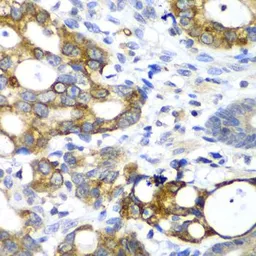 Anti-Pancreatic alpha Amylase antibody used in IHC (Paraffin sections) (IHC-P). GTX33007