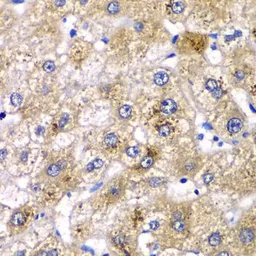 Anti-Pancreatic alpha Amylase antibody used in IHC (Paraffin sections) (IHC-P). GTX33007