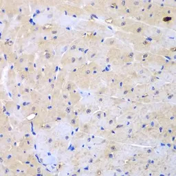 Anti-ARHGEF9 antibody used in IHC (Paraffin sections) (IHC-P). GTX33018