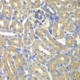 Anti-BAIAP2 antibody used in IHC (Paraffin sections) (IHC-P). GTX33034