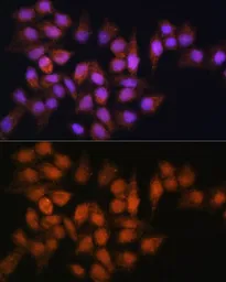 Anti-BPGM antibody used in Immunocytochemistry/ Immunofluorescence (ICC/IF). GTX33041