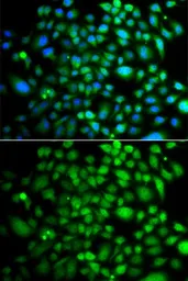 Anti-Brk antibody used in Immunocytochemistry/ Immunofluorescence (ICC/IF). GTX33043