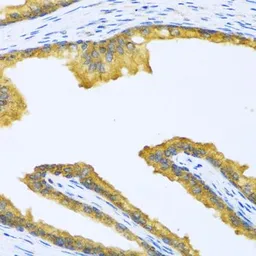 Anti-BTD antibody used in IHC (Paraffin sections) (IHC-P). GTX33046