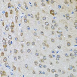 Anti-BTD antibody used in IHC (Paraffin sections) (IHC-P). GTX33046