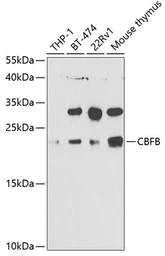 Anti-CBFb antibody used in Western Blot (WB). GTX33066