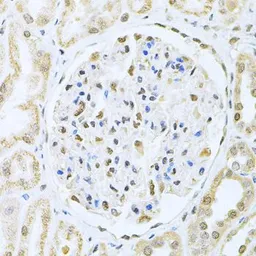 Anti-CBFb antibody used in IHC (Paraffin sections) (IHC-P). GTX33066