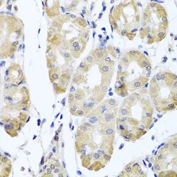 Anti-CBR4 antibody used in IHC (Paraffin sections) (IHC-P). GTX33068