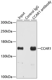 Anti-CCAR1 antibody used in Immunoprecipitation (IP). GTX33069