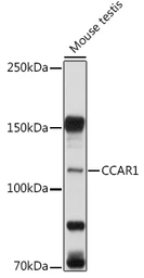 Anti-CCAR1 antibody used in Western Blot (WB). GTX33069