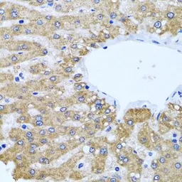 Anti-CCM2 antibody used in IHC (Paraffin sections) (IHC-P). GTX33071