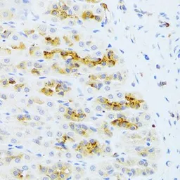Anti-CHIA antibody used in IHC (Paraffin sections) (IHC-P). GTX33093