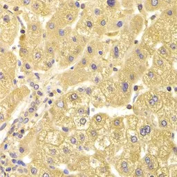 Anti-CIKS antibody used in IHC (Paraffin sections) (IHC-P). GTX33095