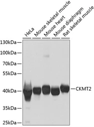Anti-CKMT2 antibody used in Western Blot (WB). GTX33098
