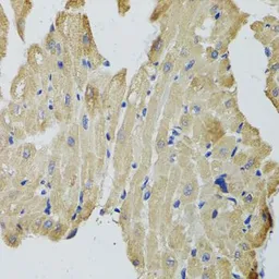 Anti-CKMT2 antibody used in IHC (Paraffin sections) (IHC-P). GTX33098