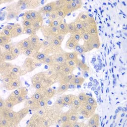 Anti-CYP2C18 antibody used in IHC (Paraffin sections) (IHC-P). GTX33135