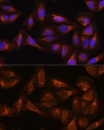 Anti-DAAM2 antibody used in Immunocytochemistry/ Immunofluorescence (ICC/IF). GTX33141