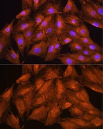 Anti-DAAM2 antibody used in Immunocytochemistry/ Immunofluorescence (ICC/IF). GTX33141