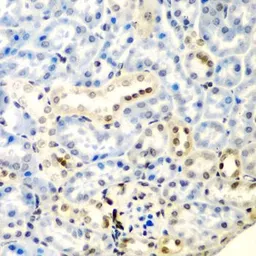 Anti-DCTD antibody used in IHC (Paraffin sections) (IHC-P). GTX33147