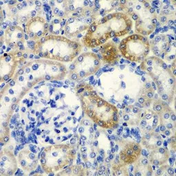 Anti-DCTD antibody used in IHC (Paraffin sections) (IHC-P). GTX33147