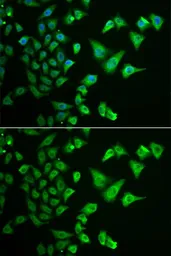 Anti-DHRS2 antibody used in Immunocytochemistry/ Immunofluorescence (ICC/IF). GTX33152
